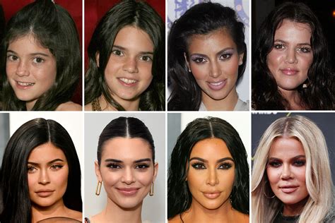 kardashian before and after photos.